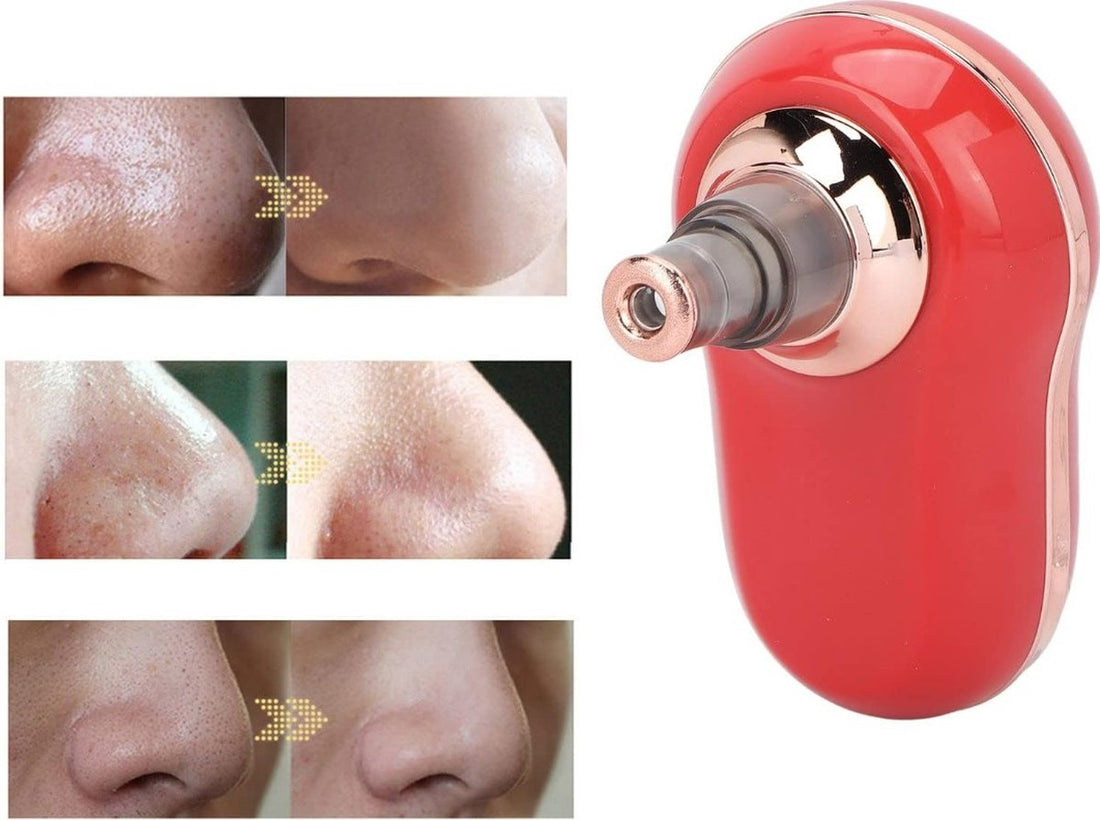Electric Blackhead Remover - Blackheads - Remove blackheads - Electric - Rechargeable - Skincare